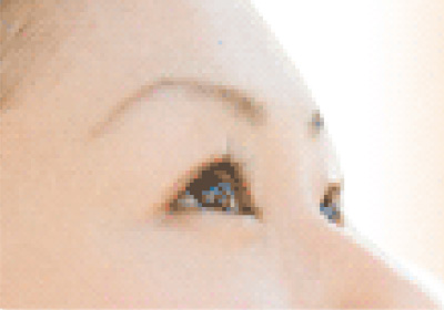 ドライアイのイメージ写真