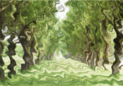 網膜前膜OCT画像